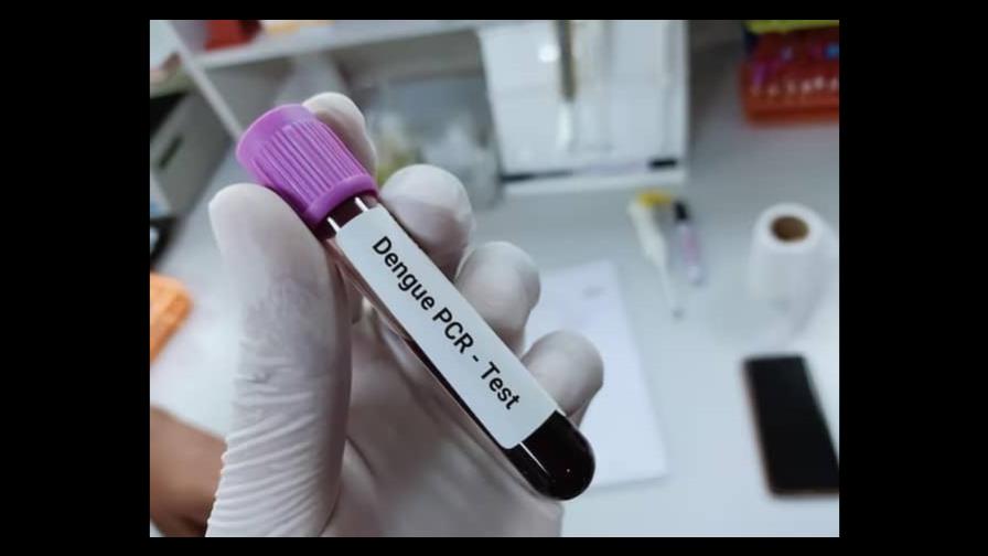Realizan Prueba Pcr Para Agilizar Resultados De Muestra De Dengue