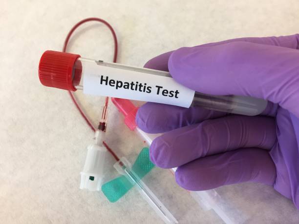 El 4 % De Los Consumidores De Droga Del País Padece Vih, Hepatitis C O Tuberculosis