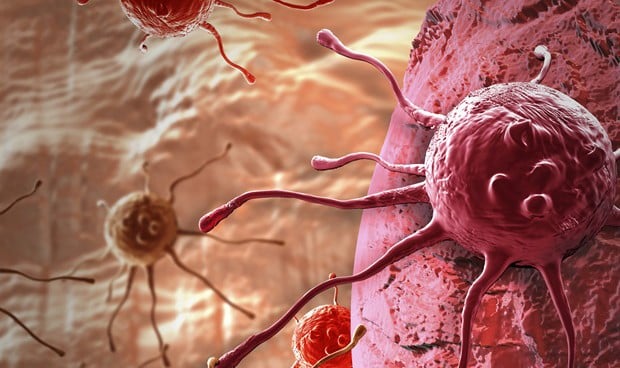 Los Casos De Cáncer Entre Personas De 14 A 49 Años Aumentaron En Casi 80%