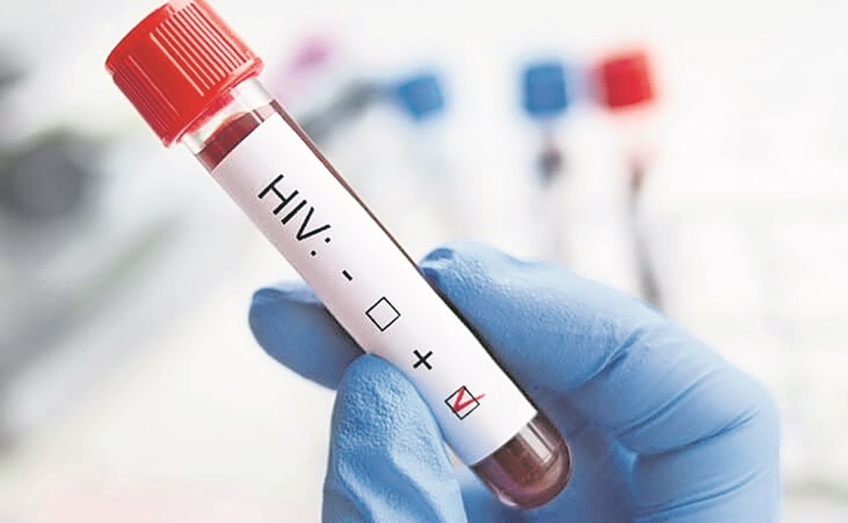 Estiman Más De 78 Mil Personas Tienen Vih En Rd; Trabajan En Adherir Pacientes A Tratamiento Antirretroviral